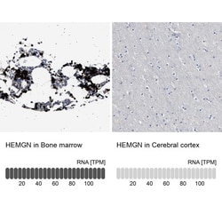 Hemogen Antibody, Novus Biologicals:Antibodies:Primary Antibodies